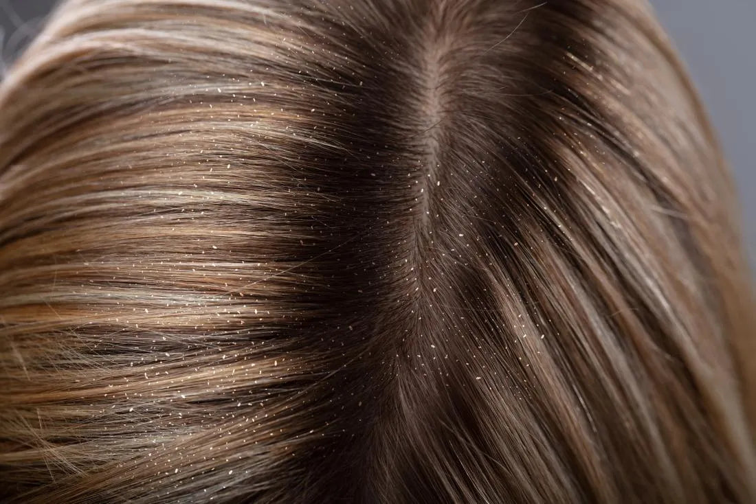 Capelli Grassi