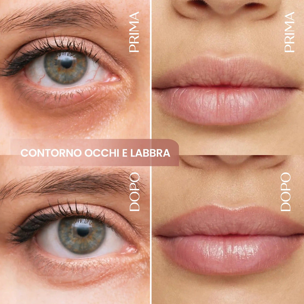 Contorno Occhi E Labbra Caffeina E Acido Ialuronico