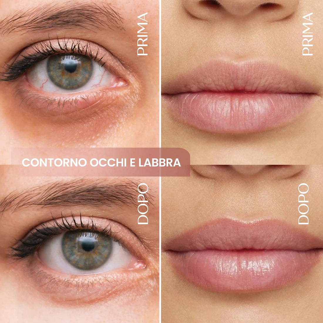 Contorno Occhi E Labbra Caffeina E Acido Ialuronico